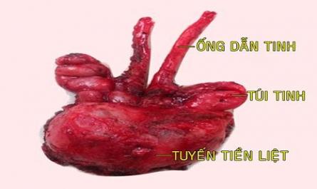 Thời Gian Sử Dụng Thuốc Giảm Đau Sau Phẫu Thuật