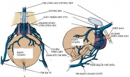 Đánh giá kết quả sớm của phẫu thuật nội soi ngoài phúc mạc cắt tuyến tiền liệt tận gốc - 2