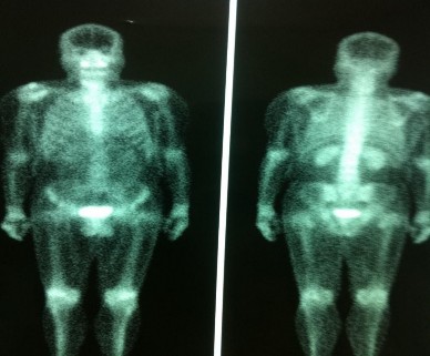 Hình 3 14 Hình xạ hình xương ― Nguồn Hà Ngọc T 1957 số hồ sơ 212 18972 ‖ 3 2 7 1