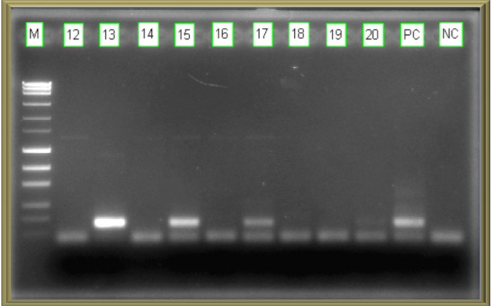 Hình 3 1 Kết quả RTPCR xác định vi rút đường ruột Hình 3 2 Kết quả 4