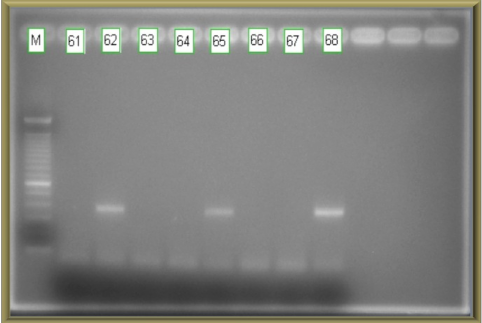 Hình 3 2 Kết quả RTPCR xác định EV71 3 2 2 Kết quả giải trình tự gen 5