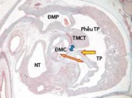 Hình 1 1 Hình ảnh phôi thai học của tim người ở tuần thứ 8 42 1 2 1 2 Phôi thai 1