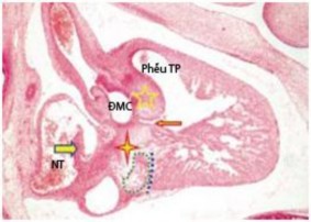 Hình 1 1 Hình ảnh phôi thai học của tim người ở tuần thứ 8 42 1 2 1 2 Phôi thai 2