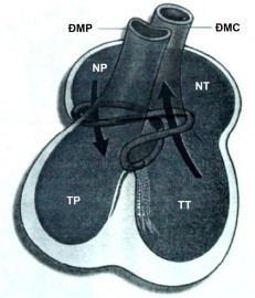 Hình 1 2 Giả thuyết về sự hình thành bệnh TPHĐR 43 Anderson và cộng sự xếp 4