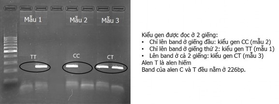 Hình 3 1 Kết quả xác định kiểu gen MTHFR rs1801133 bằng phương pháp ARMS PCR Mẫu 1