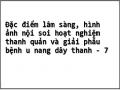 Đặc điểm lâm sàng, hình ảnh nội soi hoạt nghiệm thanh quản và giải phẫu bệnh u nang dây thanh - 7