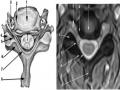 Mri Cắt Dọc Cột Sống Cổ Ở Người Trẻ Có Cột Sống Cổ Bình Thường