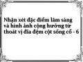 Các Triệu Chứng Và Dấu Hiệu Lâm Sàng Của Nhóm Có Hội Chứng Chèn Ép Rễ Đơn Thuần