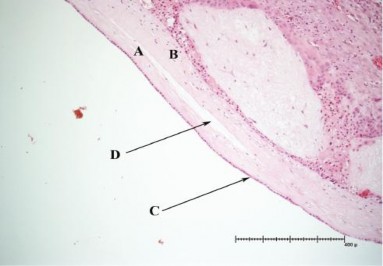 Hình 1 1 Màng đệm màng ối 9 A màng ối B màng đệm C biểu mô màng ối D mạng 1
