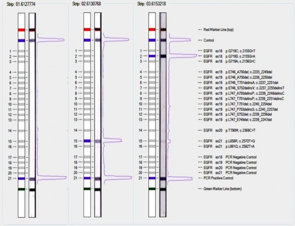 Hình 1 5 Phân tích kết quả trên thanh teststrip Trên mỗi thanh teststrip có sẵn 4