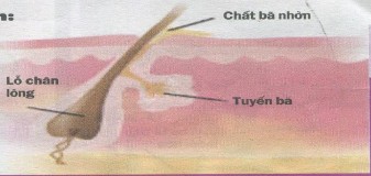 Hình 2 1 Cấu trúc nang lông tuyến bã da bình thường Nguyễn Thị Huyền 2013 Sừng 1