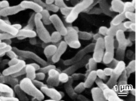 Hình 2 3 Vi khuẩn Propionibacterium acnes Nguồn Jappe et al 2002 2 2 2 Phân loại vi khuẩn 1