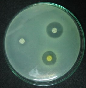 cefuroxim 12 mm clindamycin 0 mm erythromycin 16 mm levofloxacin 9 mm tetracyclin 10 mm 2