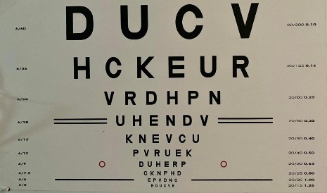 Hình 2 2 Bảng thị lực Đo khúc xạ chủ quan Thử kính cầu phân kỳ hoặc kính 1