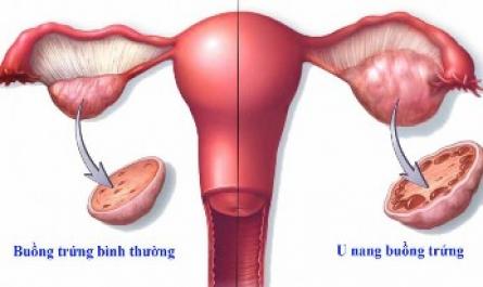 Các Tổn Thương Lành Tính Khác Của Đường Sinh Dục Dưới